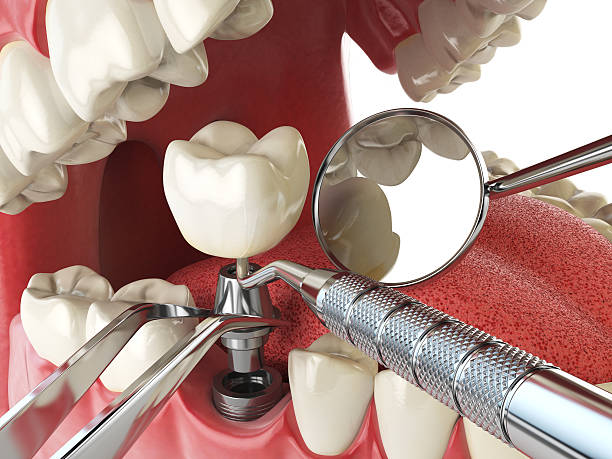 Best Weekend Emergency Dental Services in Surrey, ND