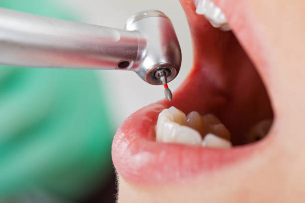 Best Weekend Emergency Dental Services in Surrey, ND